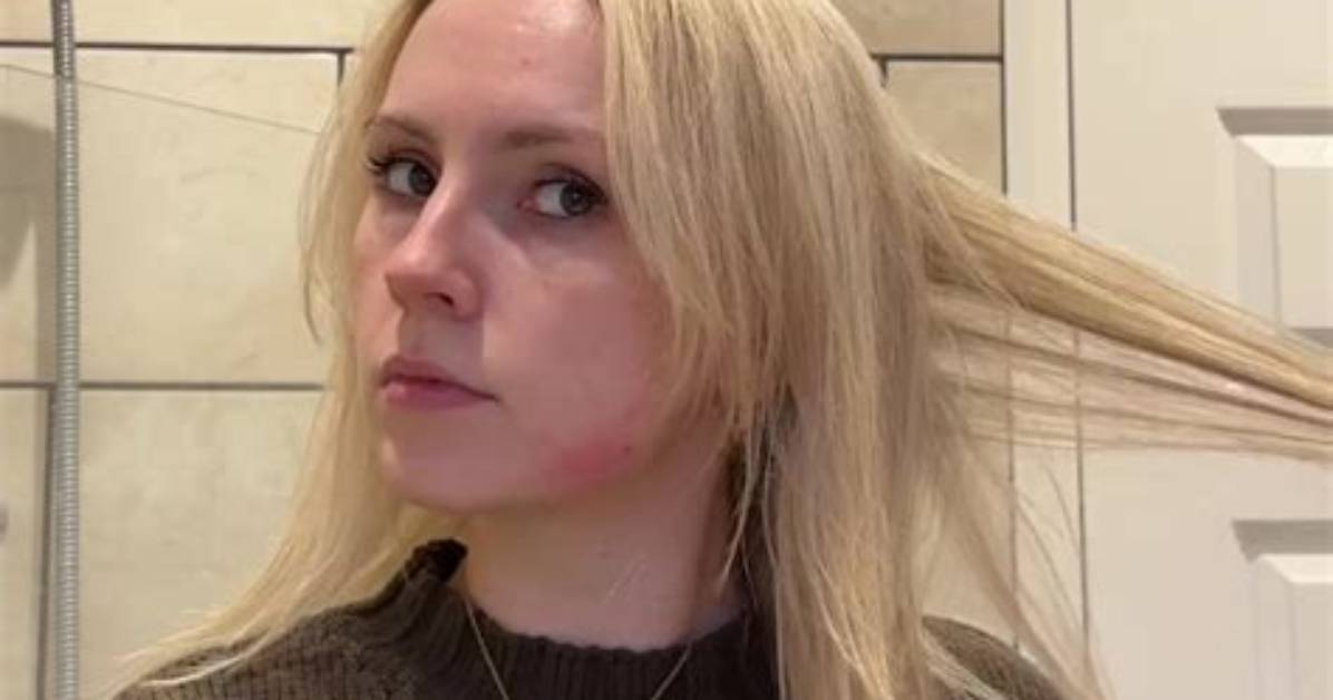 Abbey Yung Hair Transformation Real Results and Before And