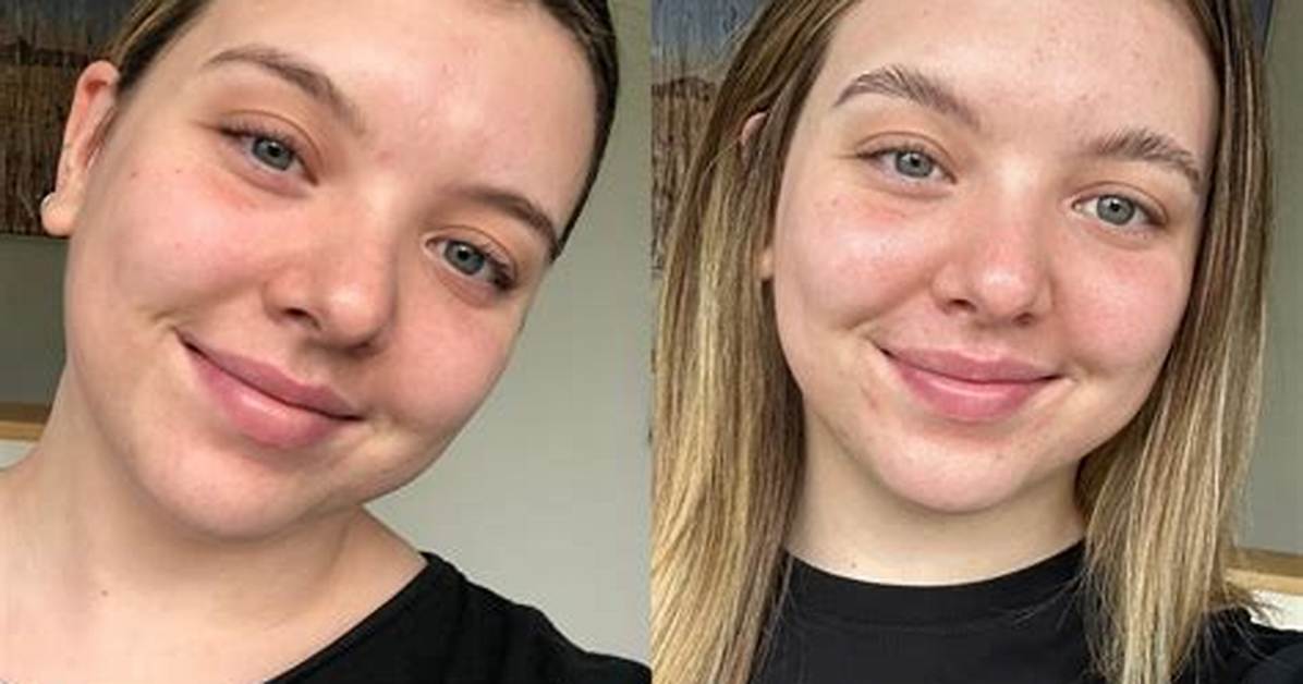 Before and After How