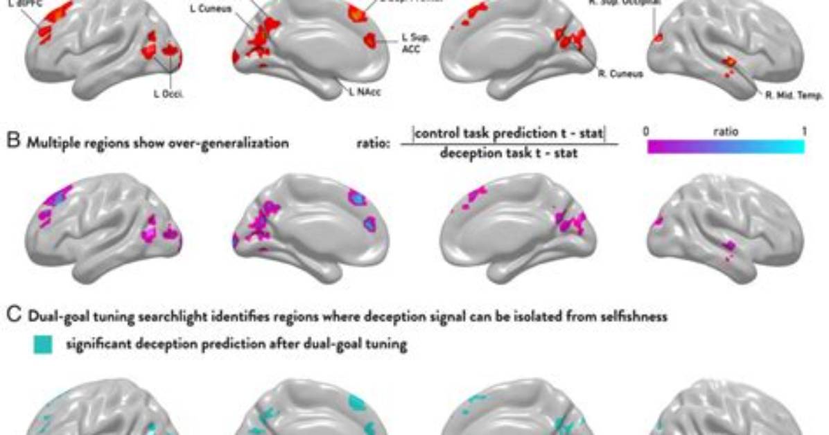 Brain Scans Don T Lie Direct Evidence Showing Which Foods Light Up
