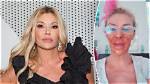 Brandi Glanville Nair Burn Incident: Timeline of the Reality Star’s Viral Video Revelation