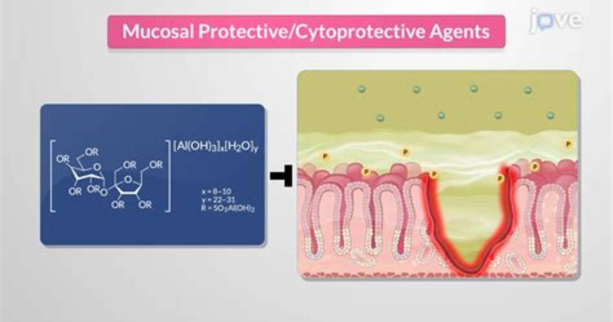Clinical Evidence How Sucralfate Physically Shields
