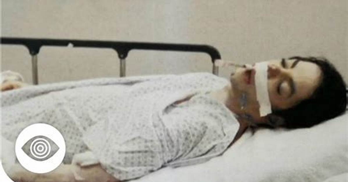 Did He Die a Painful Death Medical Realities Behind the Final