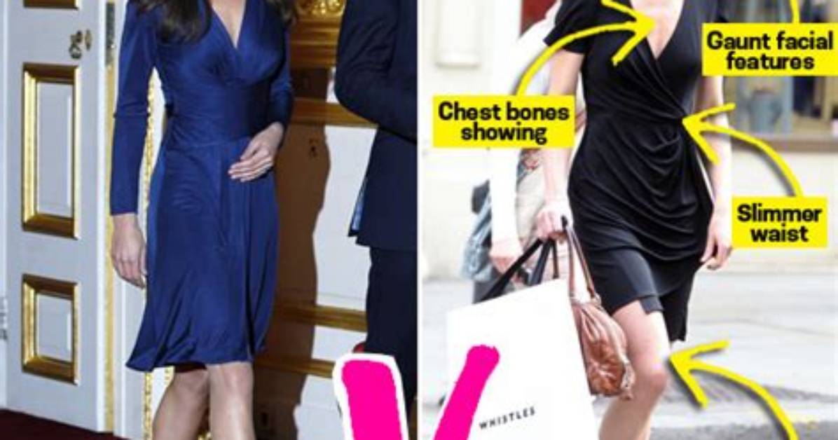 Does Kate Middleton Have an Eating Disorder Separating Fact From