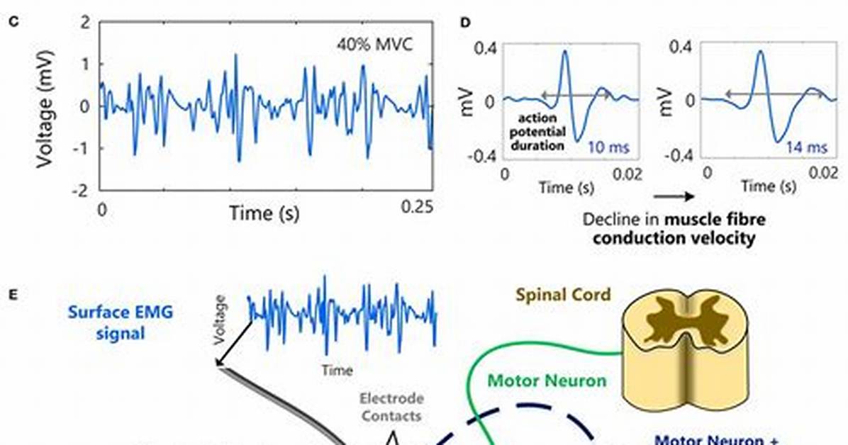 Emg Analysis and Muscle Activation Do