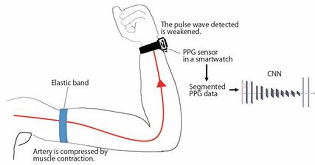 Emg Breakdown Does the Straight Arm