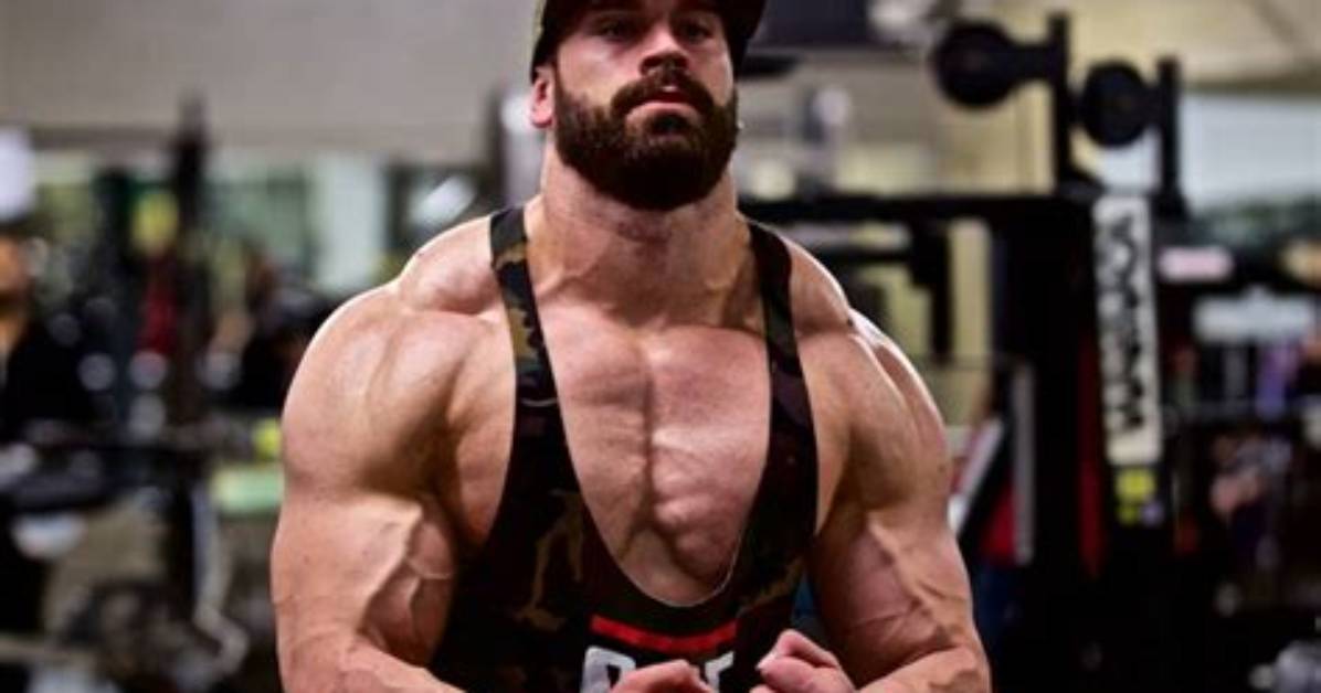 Everything to Know About Bradley Martyn S Missing Finger and His