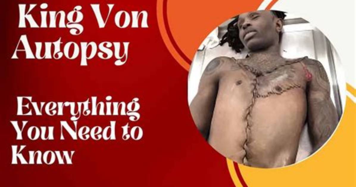 Fact Checking King Von S Autopsy Addressing Viral Reddit Rumors And