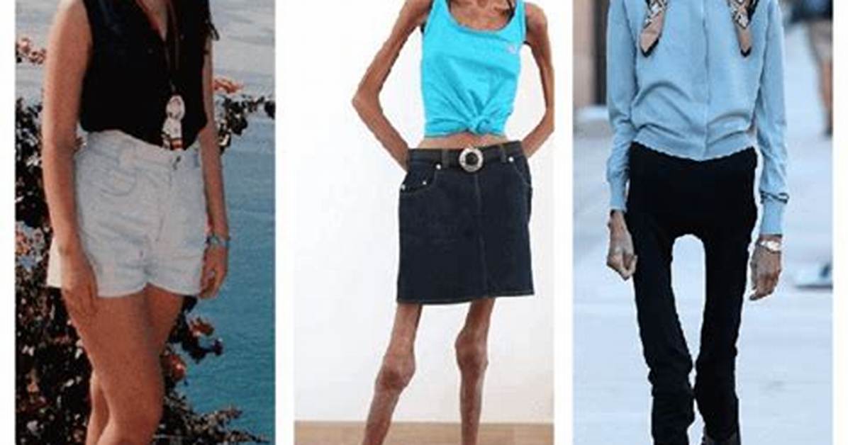 Fact Checking the World S Skinniest Person Unmasking Viral Images And