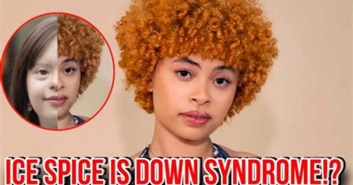 Ice Spice Down Syndrome Rumors Real Facts Behind The