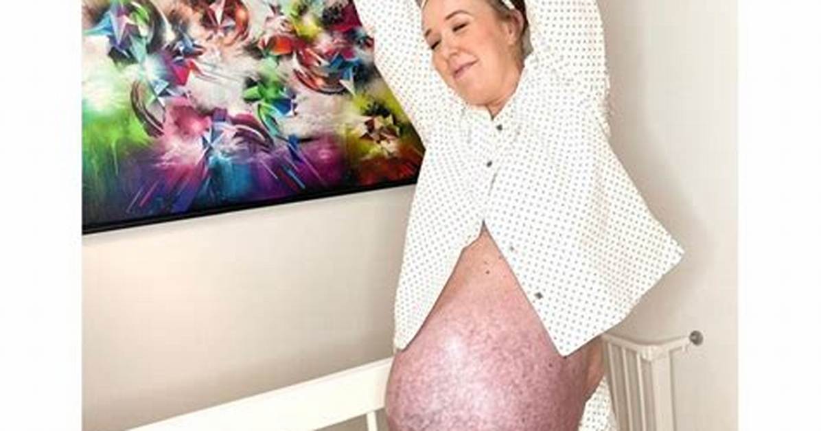 Is a Massive Pregnant Belly Dangerous Ob Gyns Break Down The