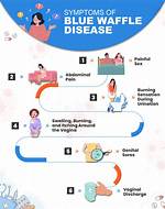 Is Blue Waffle Disease Real? Visual Proof and Medical Evidence Debunking the Myth