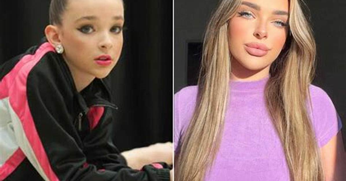 Kendall Vertes Before and After the Transformation from Lifetime Phenom To