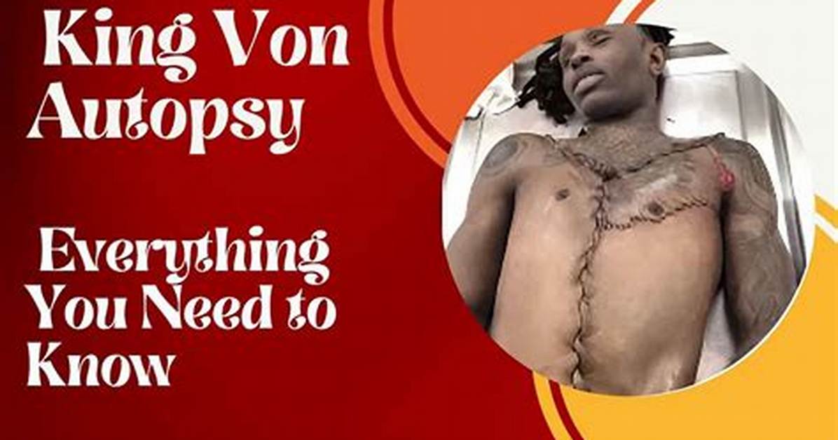 King Von Autopsy Results: a Comprehensive Look