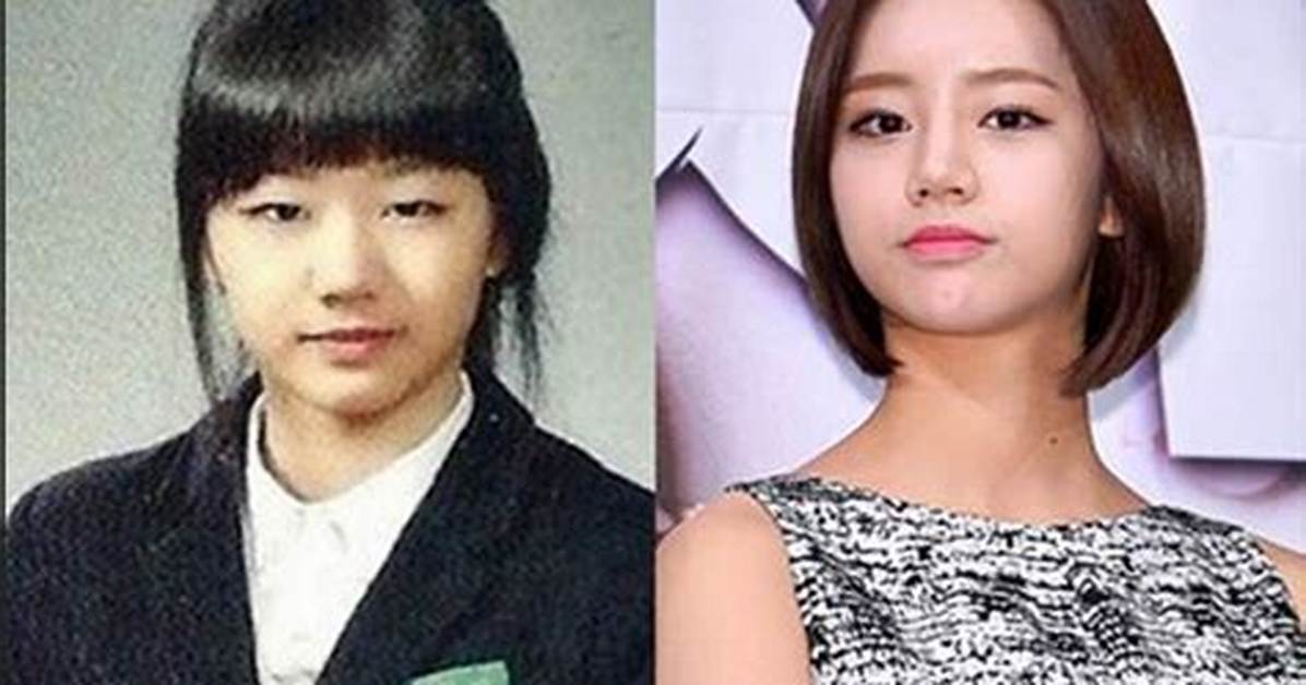 Lee Hyeri S Screen Transformation Comparing Her Weight and Fitness Across