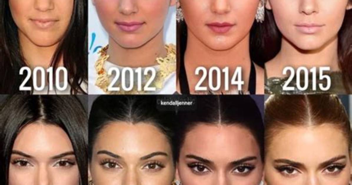 Separating Fact from Rumor What Cosmetic Procedures Has Sukihana