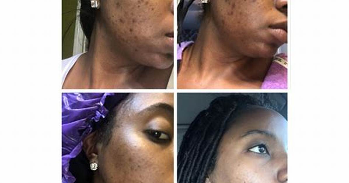Soou Rice Cream Before and After Real Texture Swatches and 30 Day