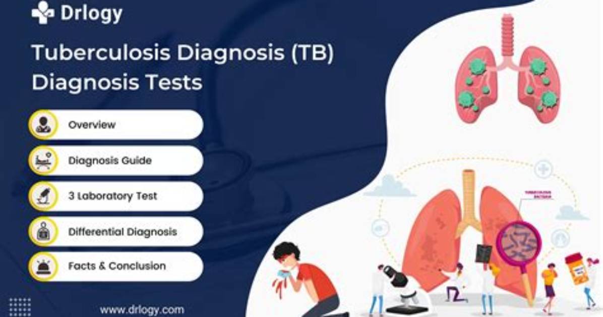 Tb Screening Updates New Diagnostics and Why Testing Protocol Is