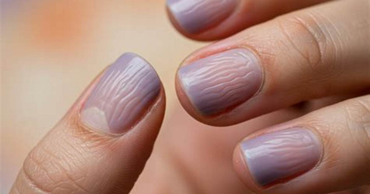 The Complete Guide to Lines in Nails Causes Treatments and At