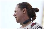 The Intriguing World of Necks: Individuals with Extraordinary Cervical Length