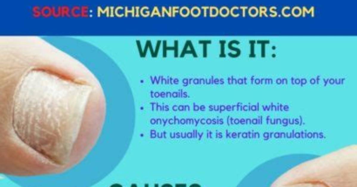 Why Are My Toenails White Doctors Debunk the Top 5