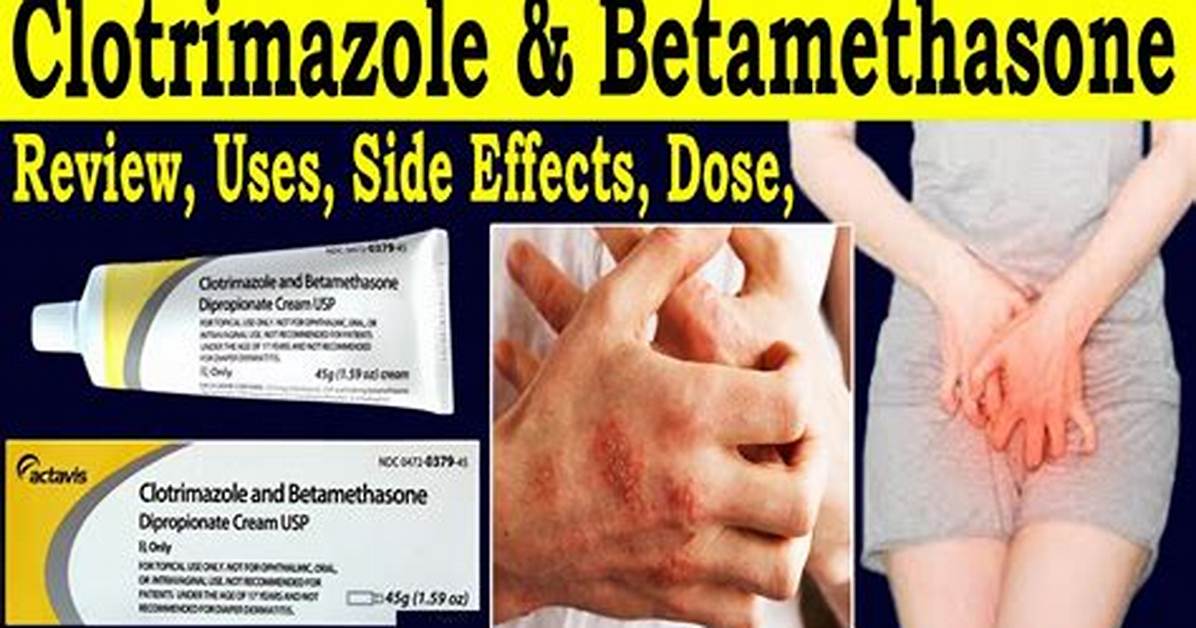 Why Putting Clotrimazole and Betamethasone On